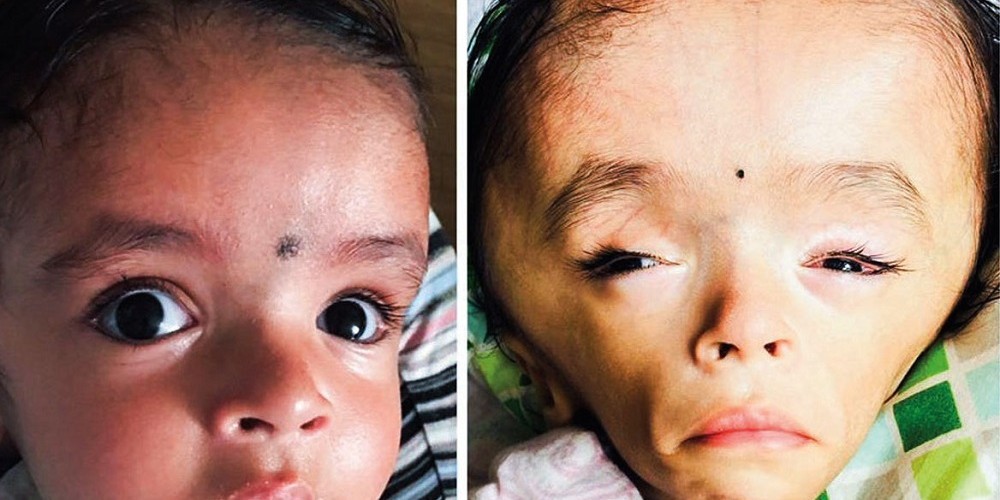 ग्रान्डीमा लापरबाहीका कारण १८ महीने शिसु जोखिममा