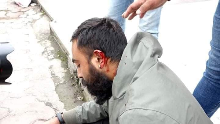 बिद्यार्थी नेता माथि लाठीचार्ज, नेबिसंघद्धारा घटनाको घोर भत्सर्ना